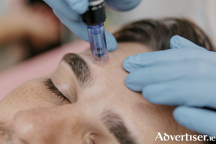 Microneedling is a treatment that will brighten, lift and tighten the skin, and make you look refreshed. Photo: iStock.